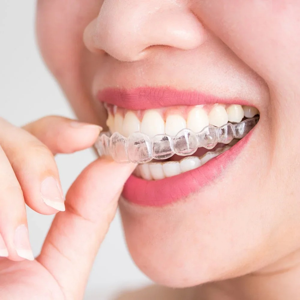 1-4Pc Anti Snoring Bruxism Sle - Teeth Whitening Mouth Guard 评论和价格
