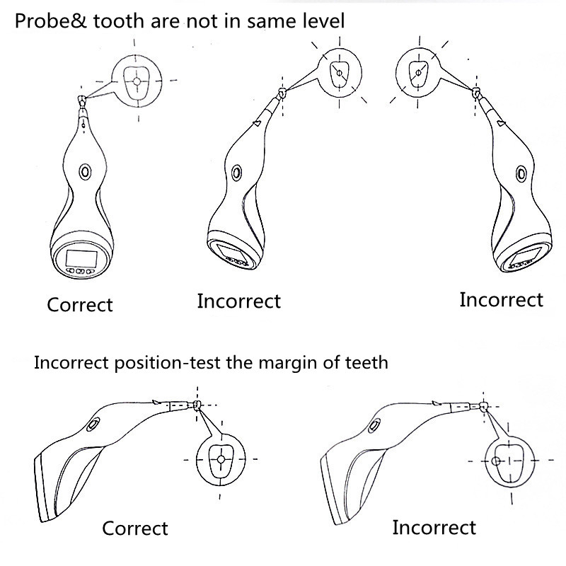 JUMTOP Dental Digital Shade Gu - Teeth Whitening Shade Guide 评论和价格