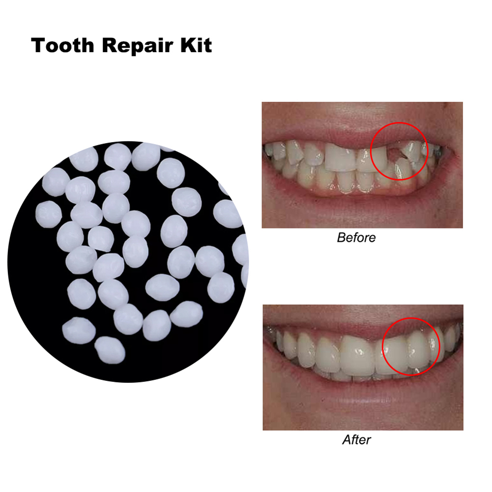 10/100g DIY Dentures Teether H - Teeth Whitening Diy 评论和价格