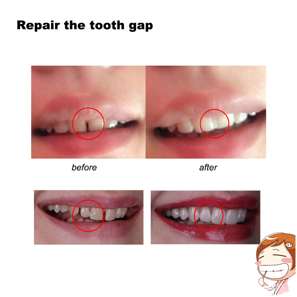 10/100g DIY Dentures Teether H - Teeth Whitening Diy 评论和价格