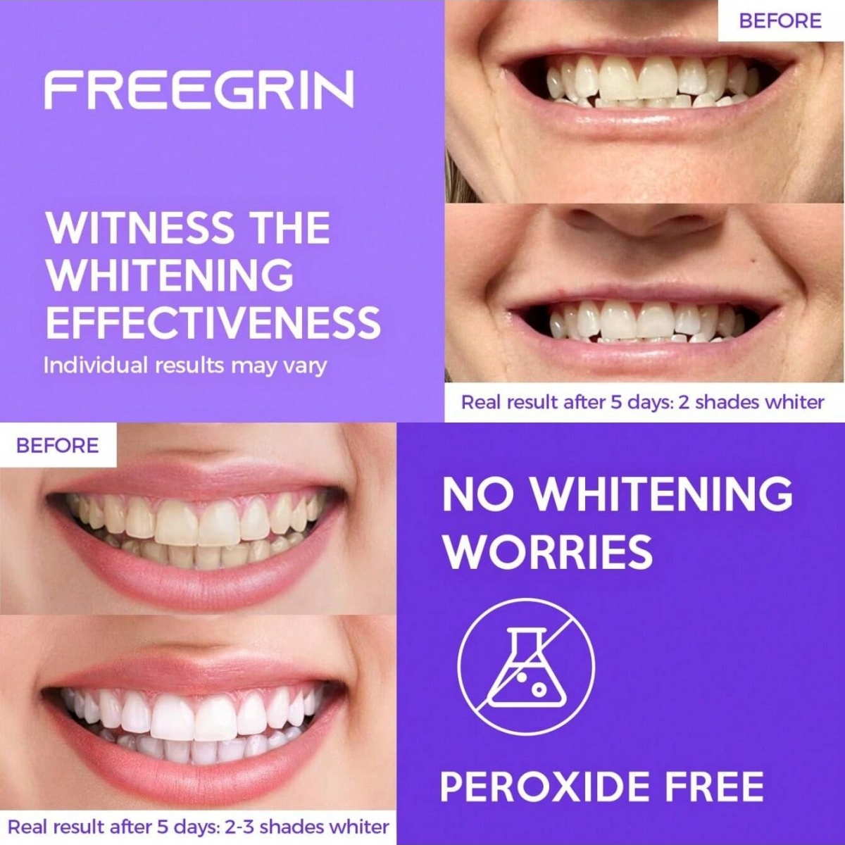 Deluxe Whitening Teeth Sticker - Teeth Whitening Singapore 评论和价格