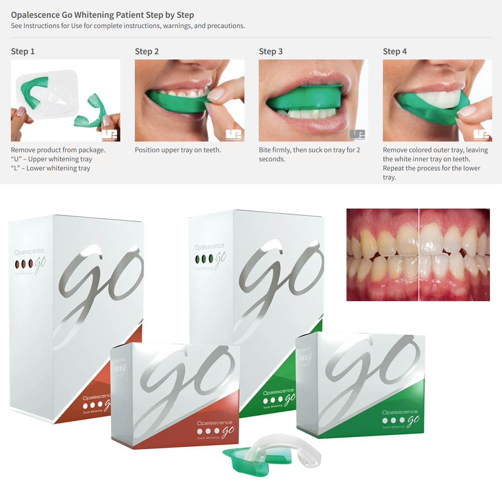 Opalescence Go Teeth Whitening - Teeth Whitening Kit At Home 评论和价格